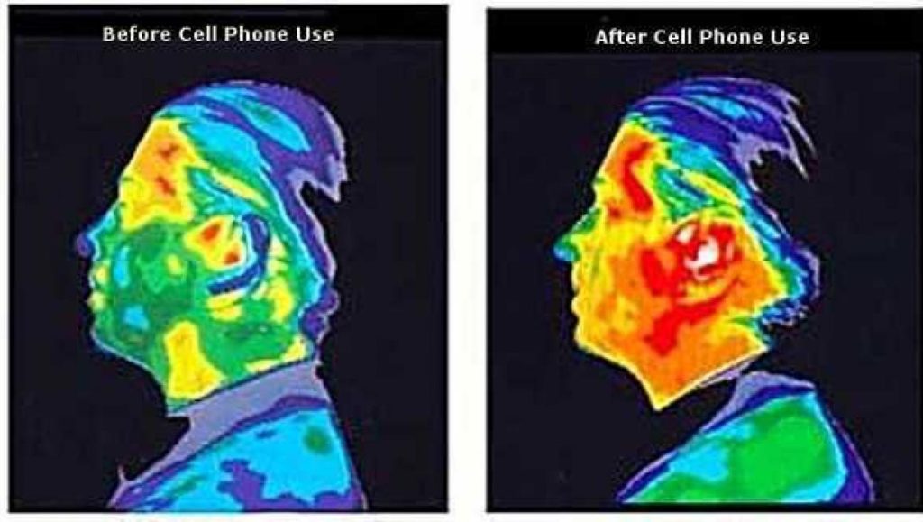 Cell phone radiation EMF Cancer Tumor